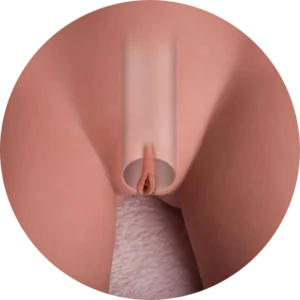 Vagina removibile